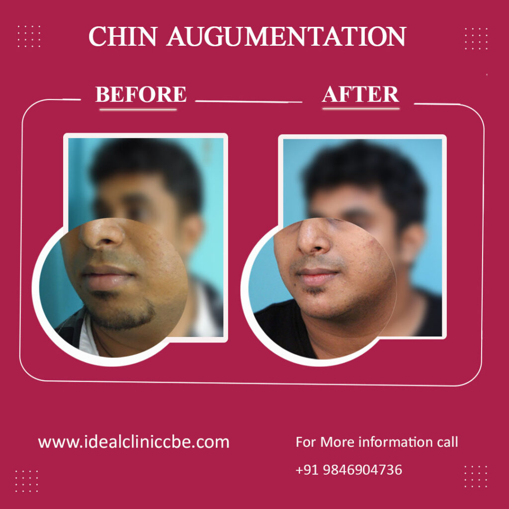 chinaugumentation